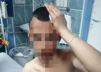 Dečak iz Smedereva brutalno pretučen