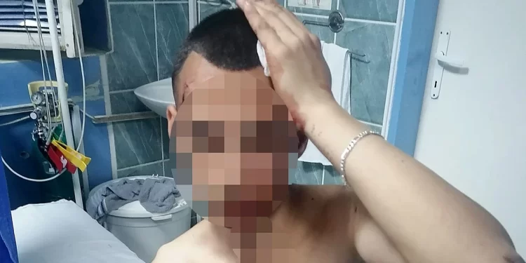 Dečak iz Smedereva brutalno pretučen